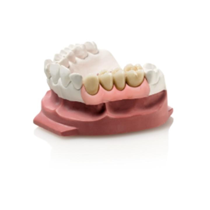 1- ZHERMACK Gingifast Elastic