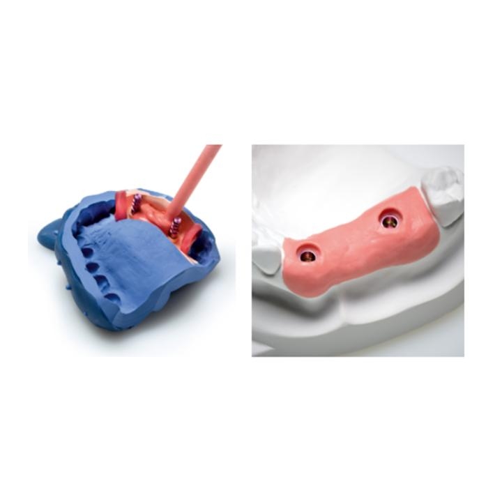 2- ZHERMACK Gingifast Rigid
